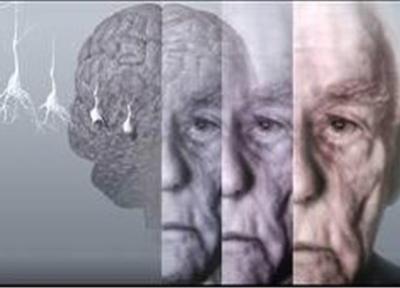 چربی های ترانسی که باعث ابتلا بهآلزایمر می شود